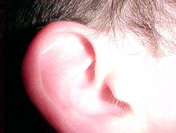 Cody's Ear